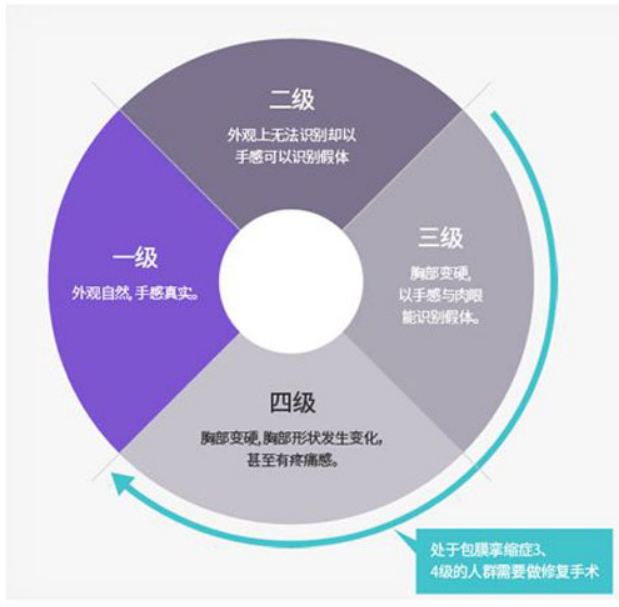 科普假体隆胸后乳房僵硬疼痛的原因及解决方法(图2)